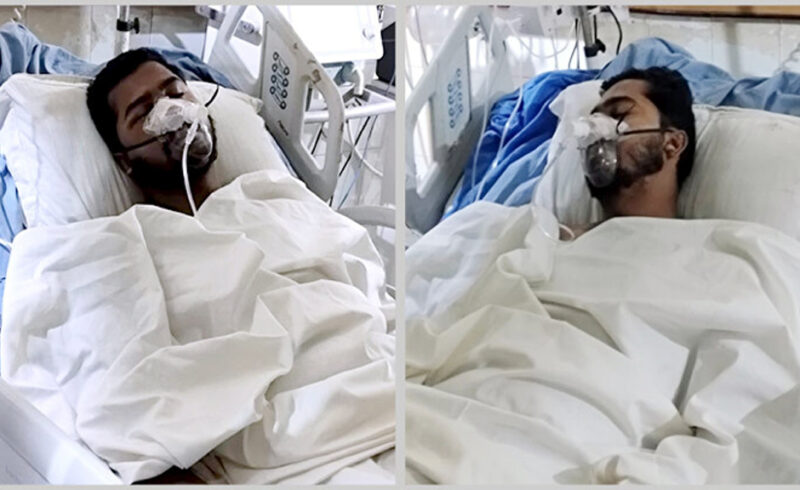 নুর আইসিইউতে, মেডিকেল বোর্ড গঠন, ভেঙে গেছে চোয়ালের হাড়
