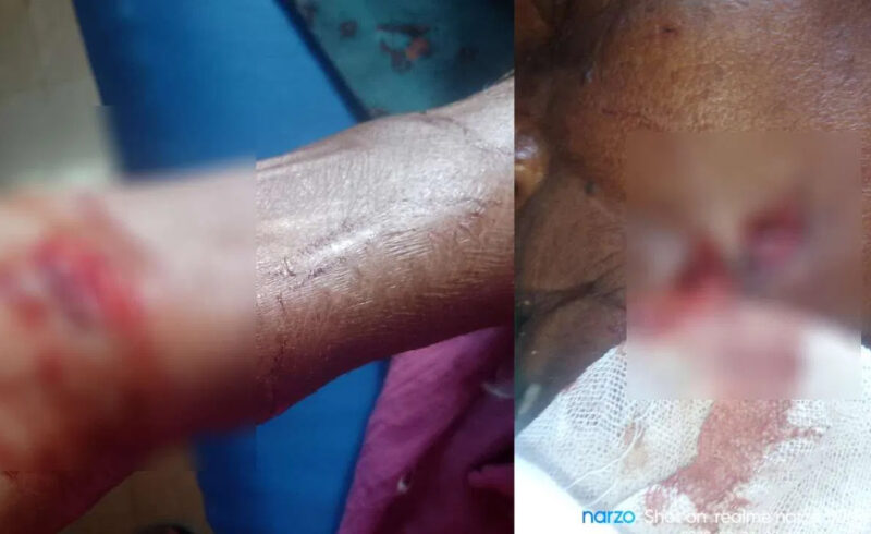 রাতের অন্ধকারে চিতাবাঘের হামলা, আহত ৪