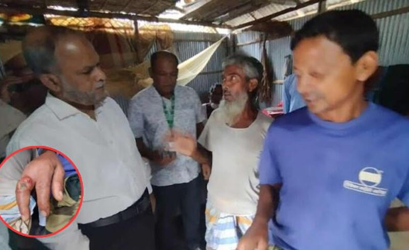 রংপুরে অ্যানথ্রাক্সের অর্ধশত মানুষ আক্রান্ত, ‘দুই শতাধিক গরুর মৃত্যু’